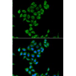 Coenzyme Q3, Methyltransferase (COQ3) Antibody