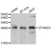 Western blot analysis of extracts of various cell lines, using ZFAND3 antibody (abx006981) at 1/1000 dilution.