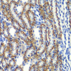 AN1-Type Zinc Finger Protein 3 (ZFAND3) Antibody