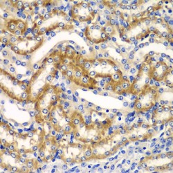 AN1-Type Zinc Finger Protein 3 (ZFAND3) Antibody