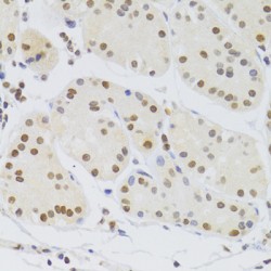 Heterogeneous Nuclear Ribonucleoprotein A1 (HNRNPA1) Antibody