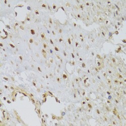 Heterogeneous Nuclear Ribonucleoprotein A1 (HNRNPA1) Antibody