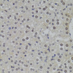 Heterogeneous Nuclear Ribonucleoprotein A1 (HNRNPA1) Antibody