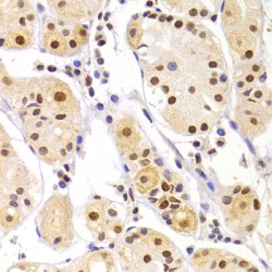 Heterogeneous Nuclear Ribonucleoprotein A1 (HNRNPA1) Antibody