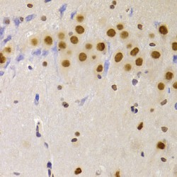 Heterogeneous Nuclear Ribonucleoprotein A1 (HNRNPA1) Antibody