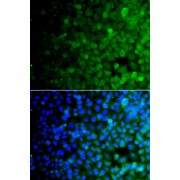 Immunofluorescence analysis of A549 cells using USP10 antibody (abx007001). Blue: DAPI for nuclear staining.