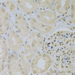 Calcium/Calmodulin Dependent Protein Kinase Type 1D (CAMK1D) Antibody