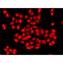 Calcium/Calmodulin Dependent Protein Kinase Type 1D (CAMK1D) Antibody