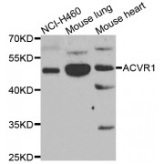 Western blot analysis of extracts of various cell lines, using ACVR1 antibody (abx007020) at 1/1000 dilution.