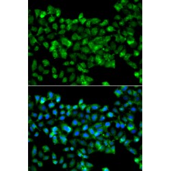 Carbonyl Reductase 3 (CBR3) Antibody