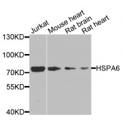 Western blot analysis of extracts of various cell lines, using HSPA6 antibody (abx007041) at 1/1000 dilution.