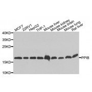 Western blot analysis of extracts of various cell lines, using PPIB antibody (abx007044) at 1/1000 dilution.