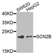 Western blot analysis of extracts of various cell lines, using SCN2B antibody (abx007046) at 1/1000 dilution.