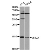 Western blot analysis of extracts of various cell lines, using UBE2A antibody (abx007047) at 1/1000 dilution.