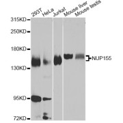 Western blot analysis of extracts of various cell lines, using NUP155 Antibody (abx007057) at 1/1000 dilution.