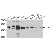 Western blot analysis of extracts of various cell lines, using STARD3 antibody (abx007061) at 1/1000 dilution.