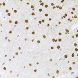 Fas (TNFRSF6) Associated Factor 1 (FAF1) Antibody