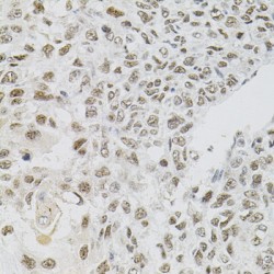 Fas (TNFRSF6) Associated Factor 1 (FAF1) Antibody