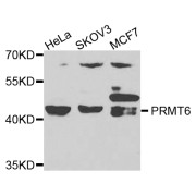 Western blot analysis of extracts of various cell lines, using PRMT6 antibody (abx007070) at 1/1000 dilution.