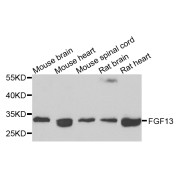 Western blot analysis of extracts of various cell lines, using FGF13 antibody (abx007086) at 1/1000 dilution.