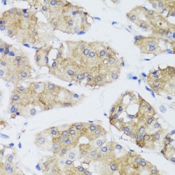 Fibroblast Growth Factor 13 (FGF13) Antibody