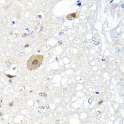 Fibroblast Growth Factor 13 (FGF13) Antibody