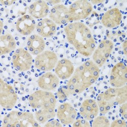 Fibroblast Growth Factor 13 (FGF13) Antibody