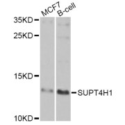 Western blot analysis of extracts of various cell lines, using SUPT4H1 Antibody (abx007095) at 1/1000 dilution.