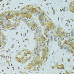 Mitochondrial Carrier Homolog 1 (MTCH1) Antibody