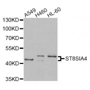 Western blot analysis of extracts of various cell lines, using ST8SIA4 Antibody (abx007126) at 1/1000 dilution.