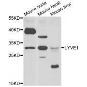 Western blot analysis of extracts of various cell lines, using LYVE1 antibody (abx007134) at 1/1000 dilution.