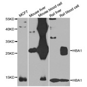 Western blot analysis of extracts of various cell lines, using HBA1 antibody (abx007141) at 1/1000 dilution.