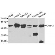Western blot analysis of extracts of various cell lines, using CFHR3 antibody (abx007150) at 1/1000 dilution.