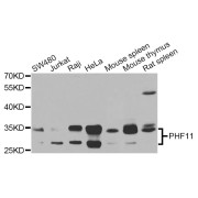 Western blot analysis of extracts of various cell lines, using PHF11 Antibody (abx007154) at 1/1000 dilution.