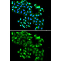 PHD Finger Protein 11 (PHF11) Antibody