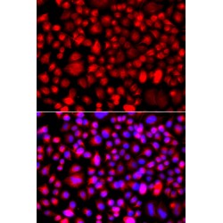 Chitobiosyldiphosphodolichol Beta-Mannosyltransferase (ALG1) Antibody