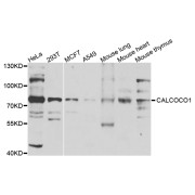 Western blot analysis of extracts of various cell lines, using CALCOCO1 antibody (abx007161) at 1/1000 dilution.