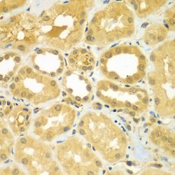 Calcium-Binding And Coiled-Coil Domain-Containing Protein 1 (CALCOCO1) Antibody