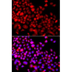 Calcium-Binding And Coiled-Coil Domain-Containing Protein 1 (CALCOCO1) Antibody