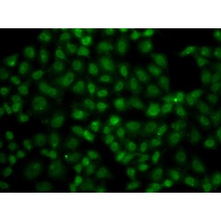 Ubiquitin Carboxyl-Terminal Hydrolase 26 (USP26) Antibody