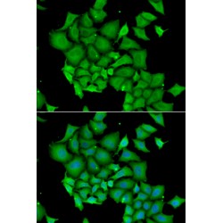 DNA Fragmentation Factor Subunit Alpha (DFFA) Antibody