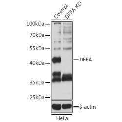 DNA Fragmentation Factor Subunit Alpha (DFFA) Antibody