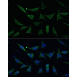 Amyloid Beta Precursor Like Protein 1 (APLP1) Antibody