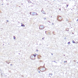 Amyloid Beta Precursor Like Protein 1 (APLP1) Antibody