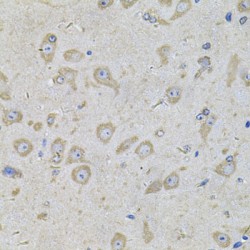 Eukaryotic Translation Initiation Factor 3 Subunit F (EIF3F) Antibody