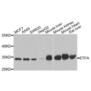 Western blot analysis of extracts of various cell lines, using ETFA antibody (abx007175) at 1/1000 dilution.