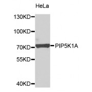 Western blot analysis of extracts of HeLa cells, using PIP5K1A antibody (abx007182) at 1/1000 dilution.