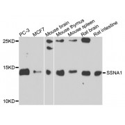 Western blot analysis of extracts of various cell lines, using SSNA1 antibody (abx007183) at 1/1000 dilution.