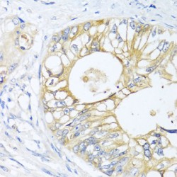 Guanine Nucleotide Binding Protein (G Protein), Alpha Inhibiting Activity Polypeptide 3 (GNAI3) Antibody