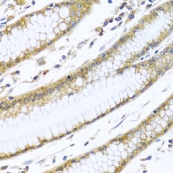 Guanine Nucleotide Binding Protein (G Protein), Alpha Inhibiting Activity Polypeptide 3 (GNAI3) Antibody